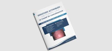 Kératoses Actiniques : le champs de cancérisation