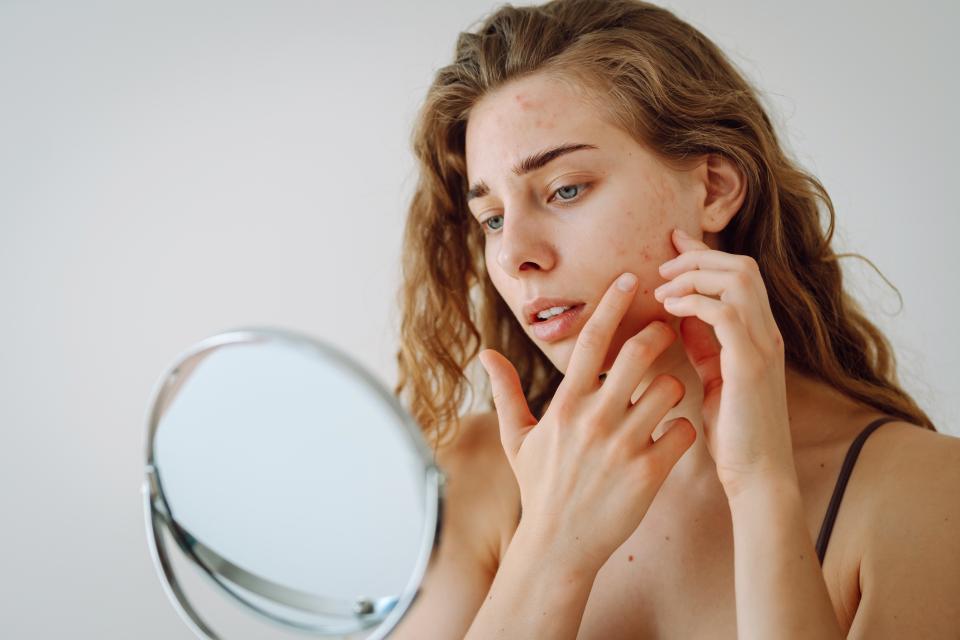Gros plan d’une femme à problèmes de peau se regardant dans le miroir.